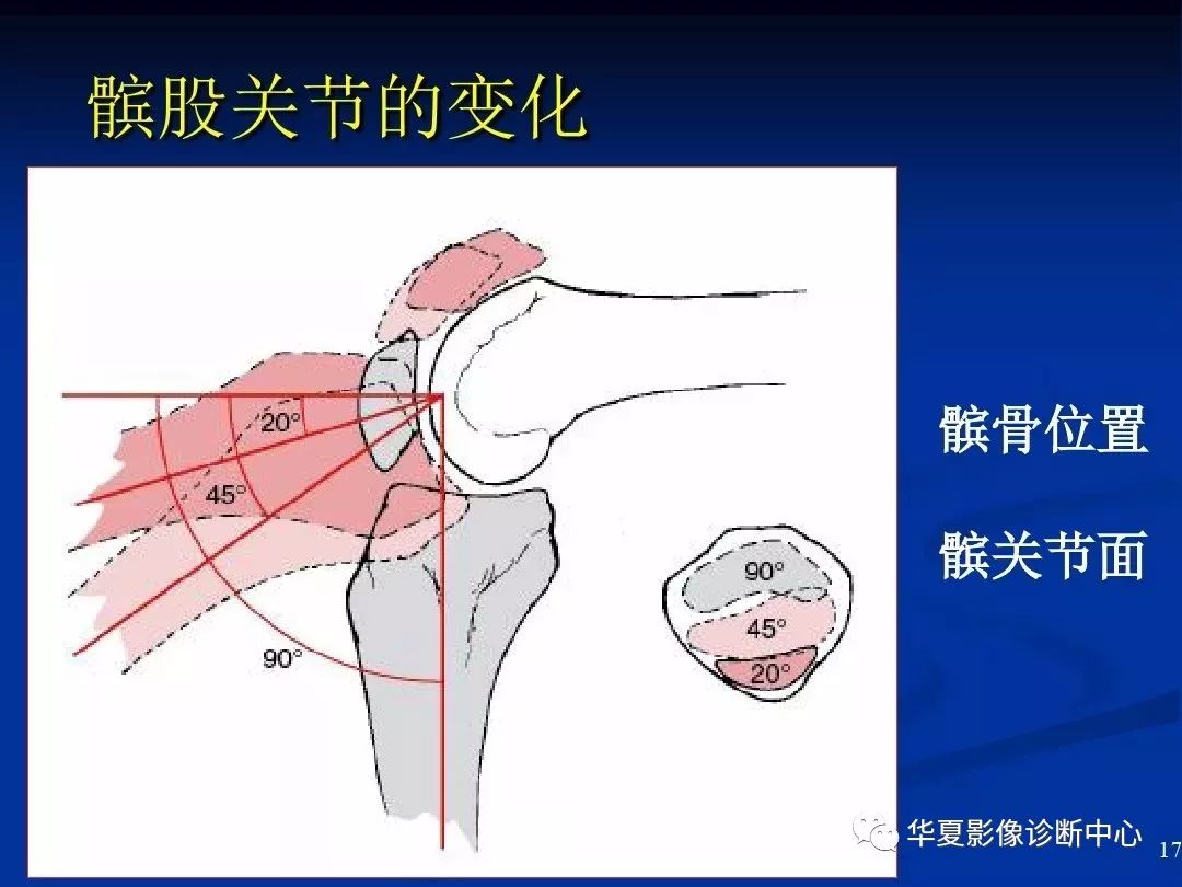 超全丨膝关节解剖基础