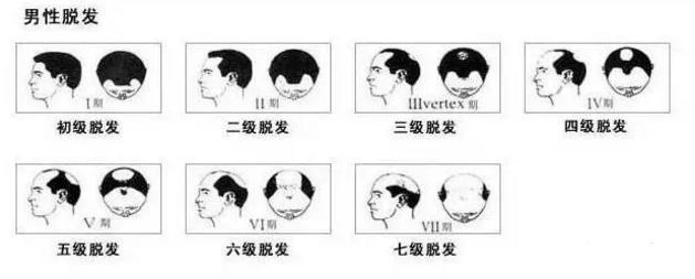 博士的发际线是一种社交工具