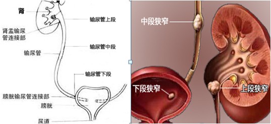 3,多摄入维生素a:维生素a对维护尿路整体健康是必需的.