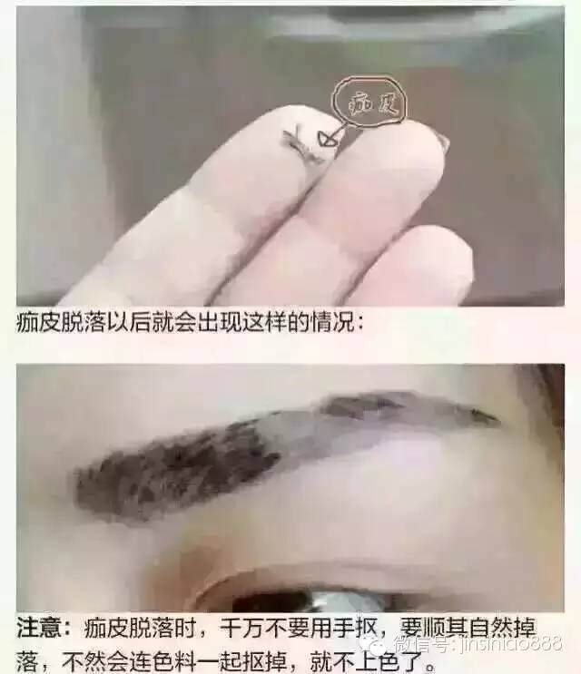 不结痂的雾眉什么原理_不结痂雾眉(2)