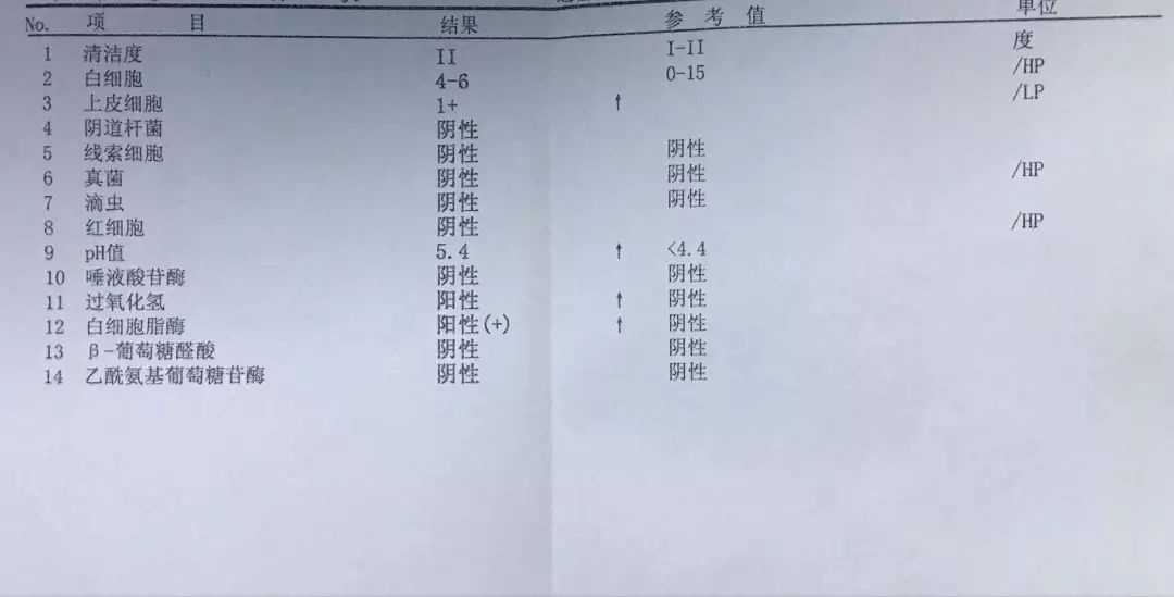 白带常规检查