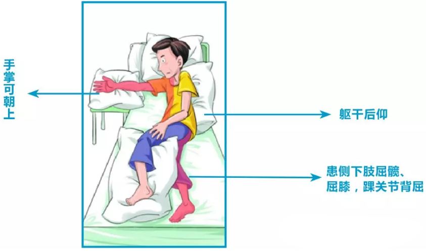 2.健侧卧位