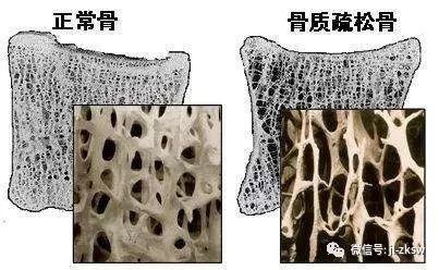 吉林中科 干细胞 减缓骨骼老化 加速骨质再生 治疗