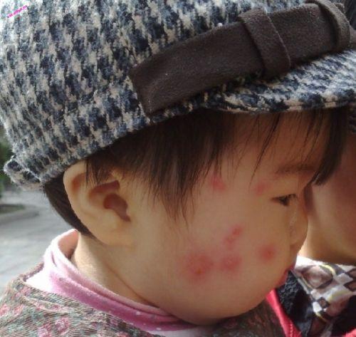                     宝宝让妈妈给挠痒痒，妈妈总挠不对地方，之后宝宝的反应太萌了