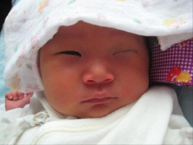                     夫妻怀疑自己孩子没有“眼睛”，带去医院做检查，医生：遗传二位