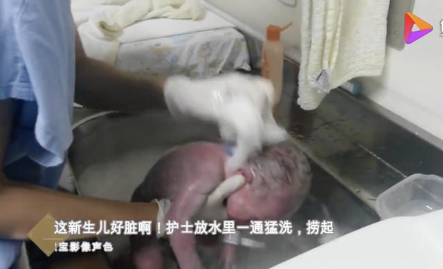                     这新生儿好脏啊！护士放水里一通猛洗，捞起来还是很脏