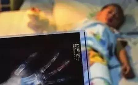                     一块钱坐一次的摇摇车，眨眼就能要了孩子的命