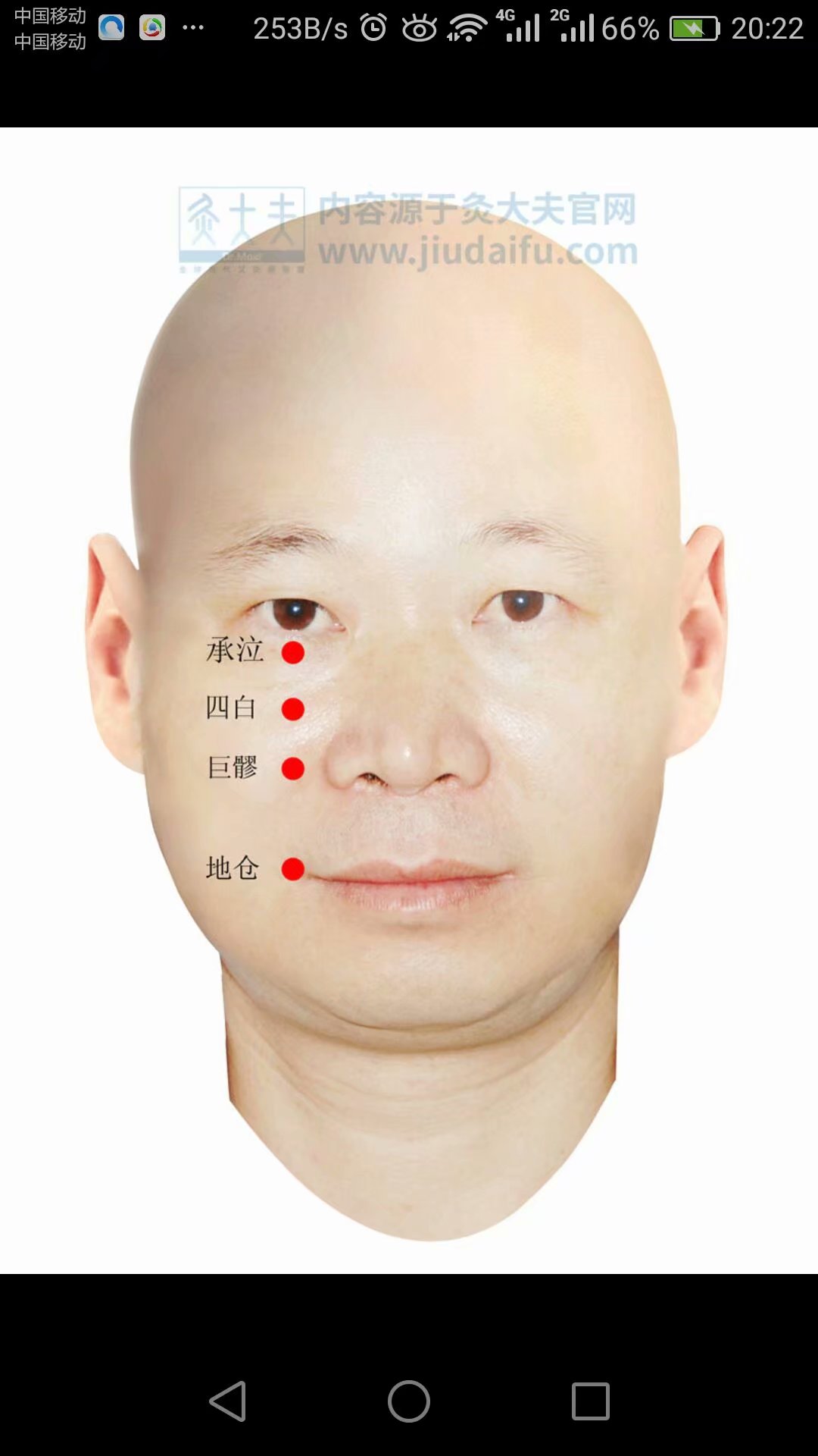 丝竹空穴:治疗偏正头痛,目眩,目赤,眼跳 睛明穴:治疗眼部诸疾患 四白