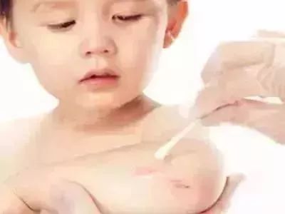                     宝宝摔伤磕伤之后，如何处理才能避免留疤？