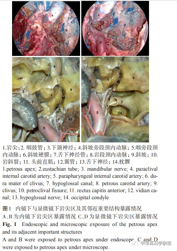 内镜下经鼻至岩尖区的临床应用解剖学研究