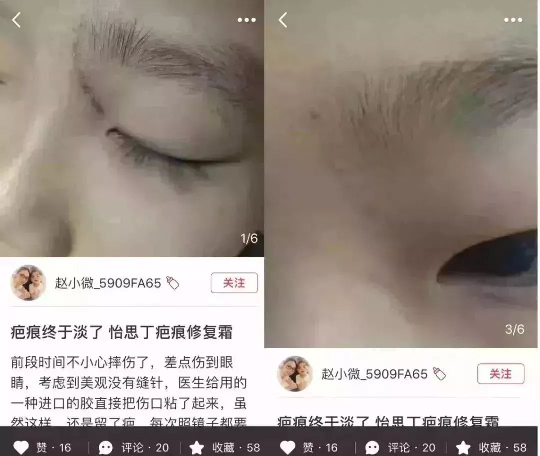                     宝宝摔伤磕伤之后，如何处理才能避免留疤？