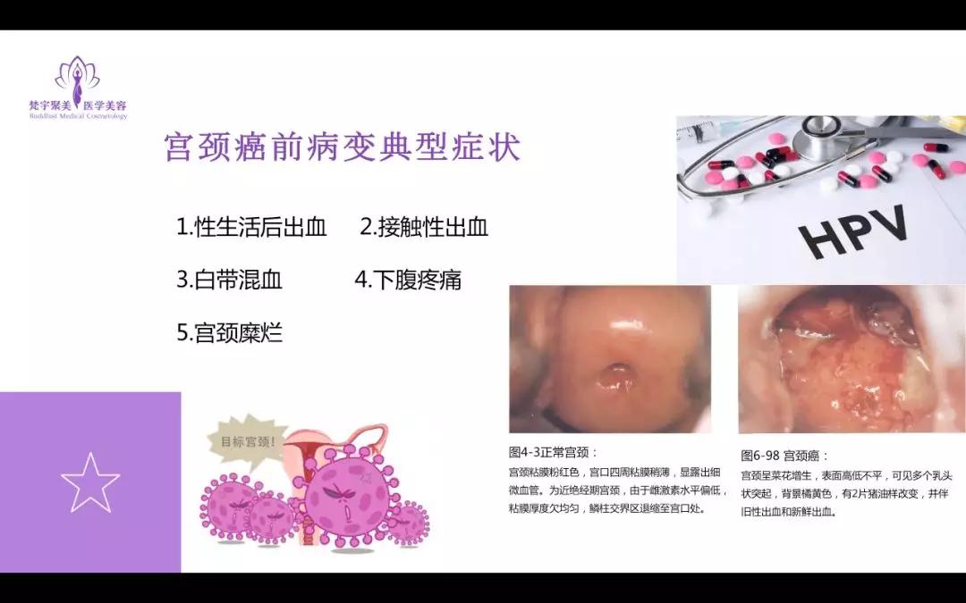 梵宇聚美|" 女人如花,生殖如根 "远离hpv!_女性