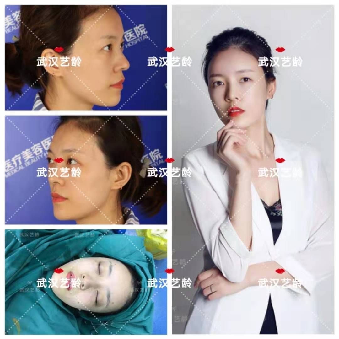 艺龄石显武整形医生的审美很重要