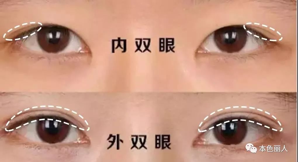 刘雯是典型的肿肿单眼皮 周冬雨是肿肿的内双 单眼皮和内双的区别