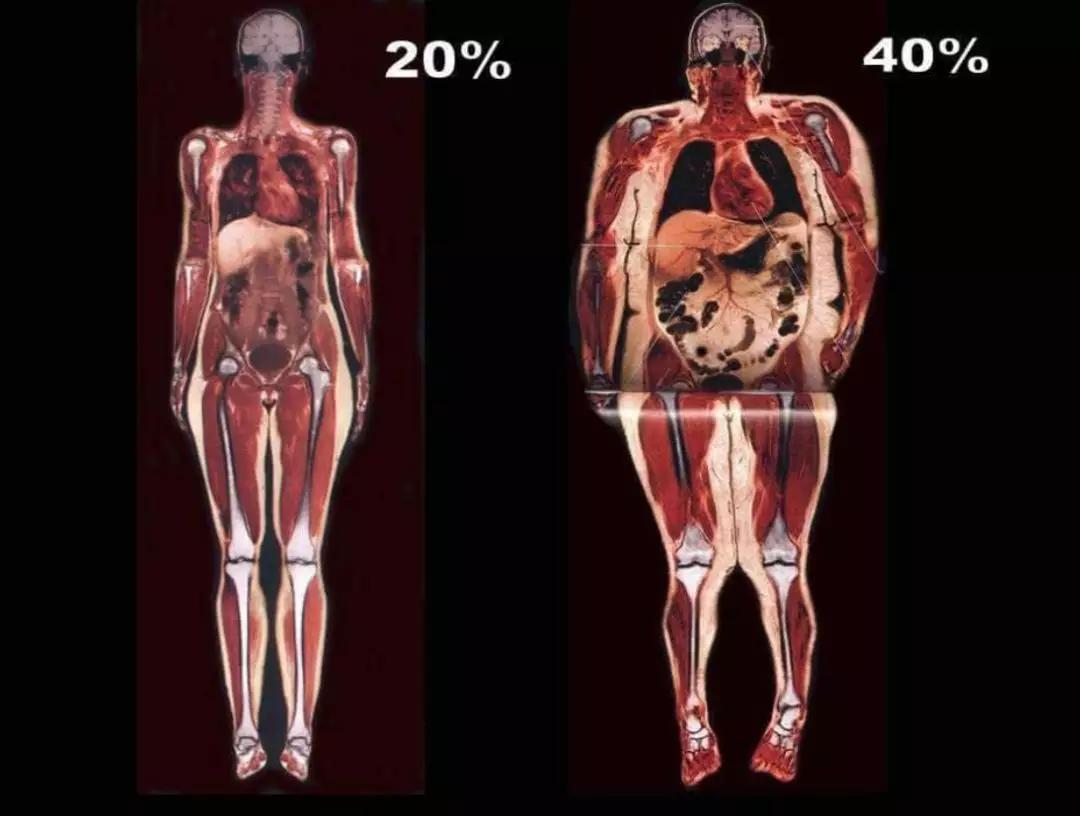 4步快速瘦腹法,吃出腹肌马甲线_脂肪