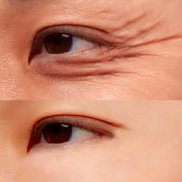 如何睡觉可以改善眼袋 0b4241354df747738daa3db867398dca.jpeg