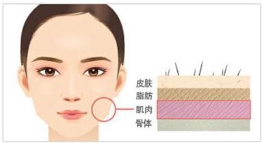 怎么看打没打瘦脸针 47381830081041d5b5ce587d9857e941.jpeg