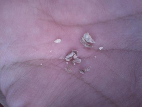 怎么样才可以不长结石 4eb5359be9f54de6a3b236f37aa29c19.png