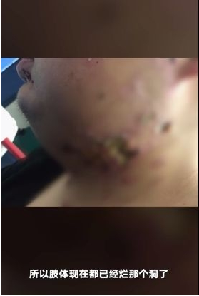 由于长时间被下载v情趣情趣旅店捆绑图片