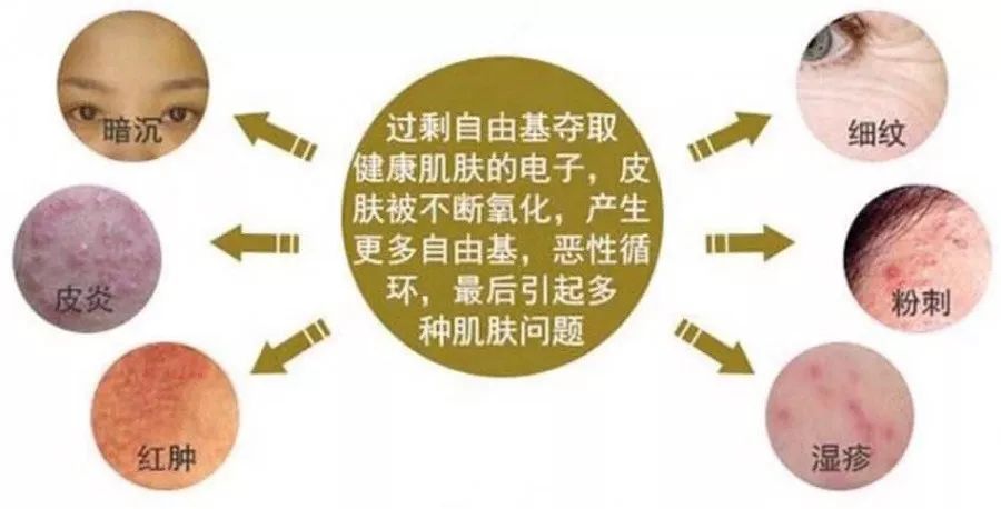 自由基是人体新陈代谢的产物,也是紫外线和不规律生活,饮食习惯,长