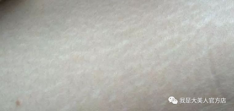 橘皮纹,那bioten瘦身乳里面还添加了海藻精华;海藻精华能够让皮肤更加