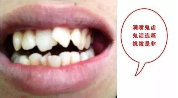 悬而未决的内心信号，解析梦到牙齿松动却不脱落的深层寓意