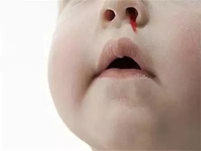 什么叫上火下火 1a11de8f4ada4a5793d8bf2d12962e98.jpeg