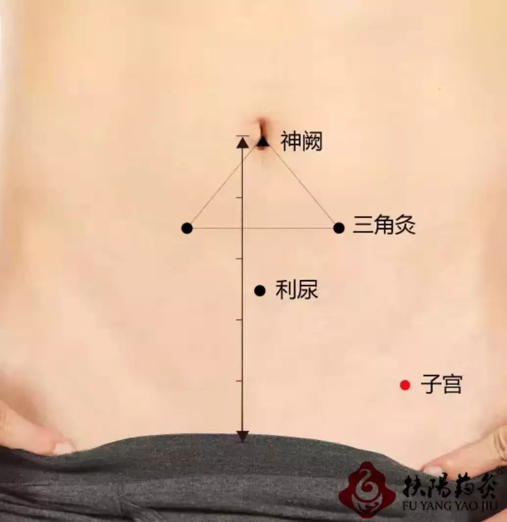 子宫肌瘤,切了竟还会长?要想消除病根,艾灸要趁早!