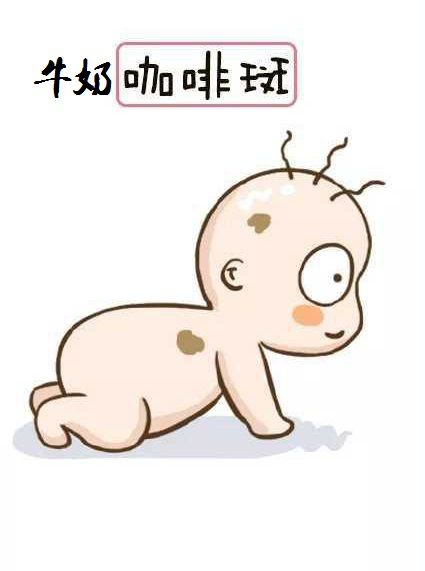 虽然没有蒙古斑发生率那么高(在中国人中接近90%),但牛奶咖啡斑在"