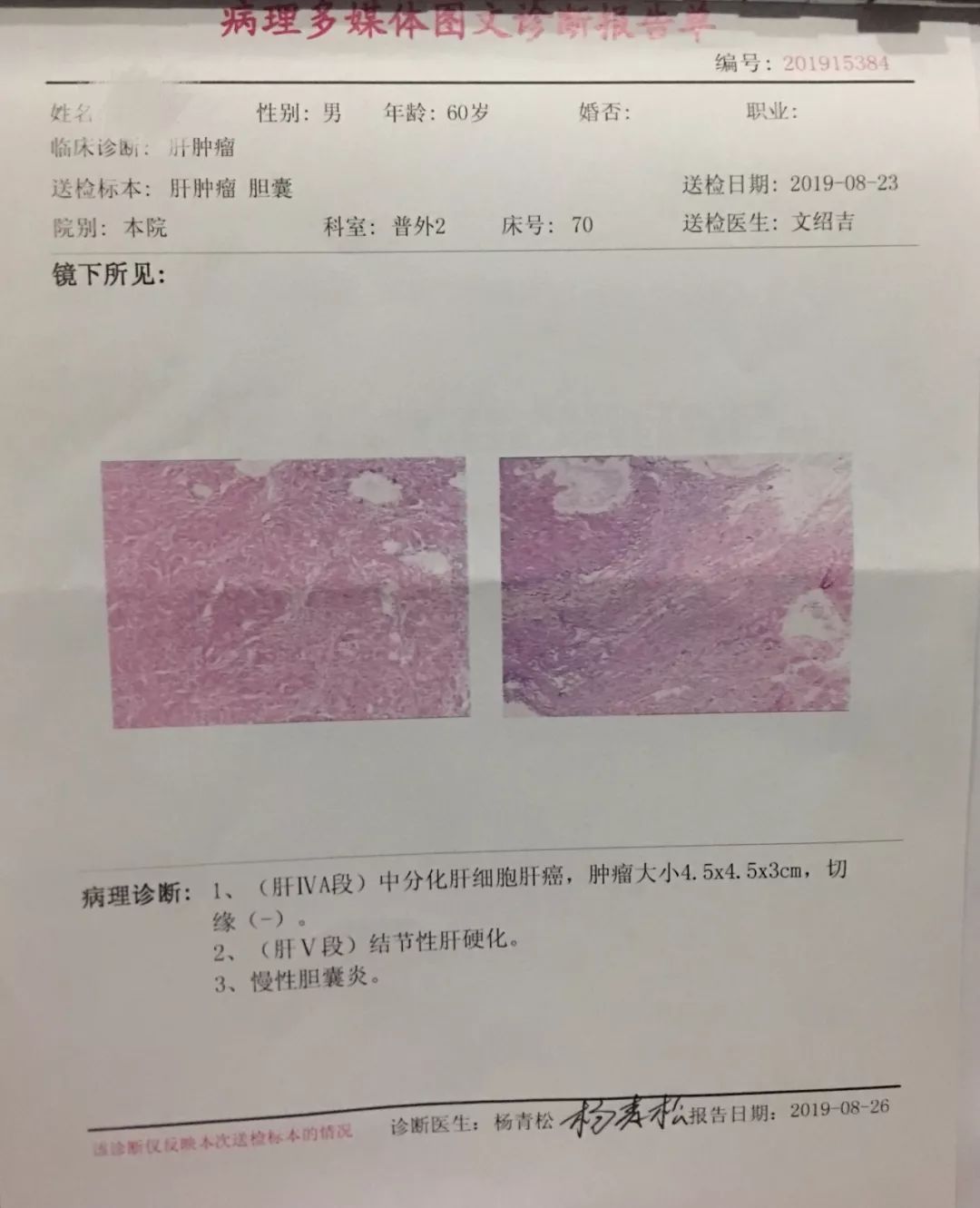 医疗技术巴中市中心医院肝癌切除已进入精准外科时代