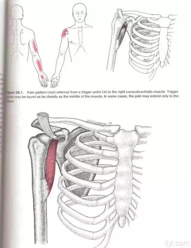 肌筋膜触发点详细图谱建议收藏