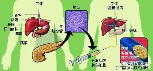 胰岛素是什么时候开始分泌的 2aff1a2ff98145e2b5d678691e44d0d5.jpeg