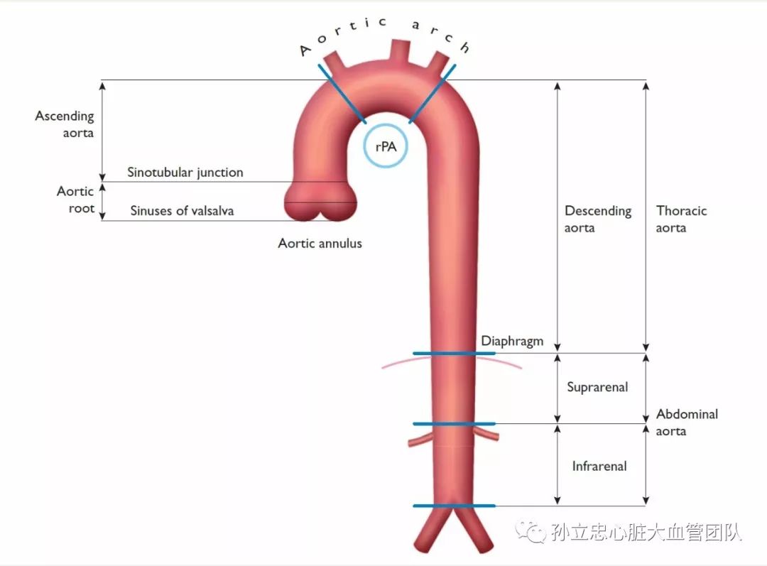 主动脉解剖图