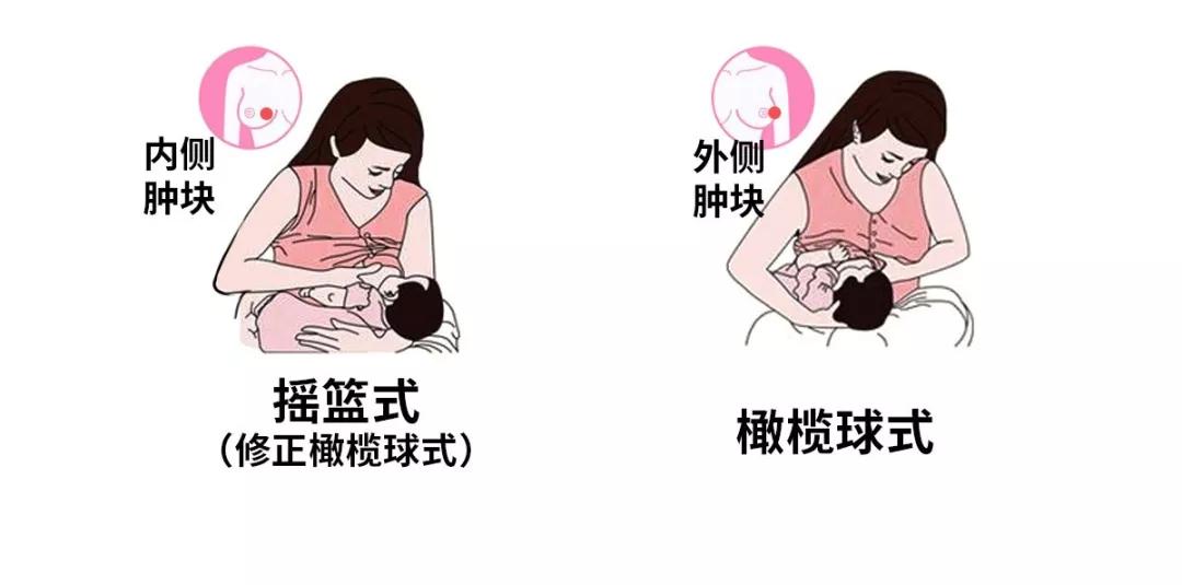 独家视频乳汁积於了怎么办这4法6招能高效排奶