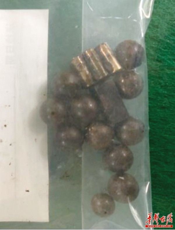                    还在给孩子买磁珠？ 模仿光头强，男孩吞食11颗磁珠肠穿孔
