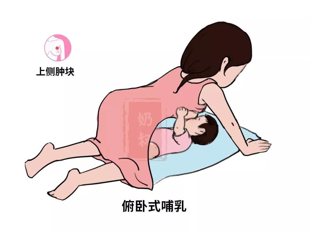 橄榄球式:有利于疏通乳房外侧的肿块 ▲俯卧式哺乳:有利于疏通乳房