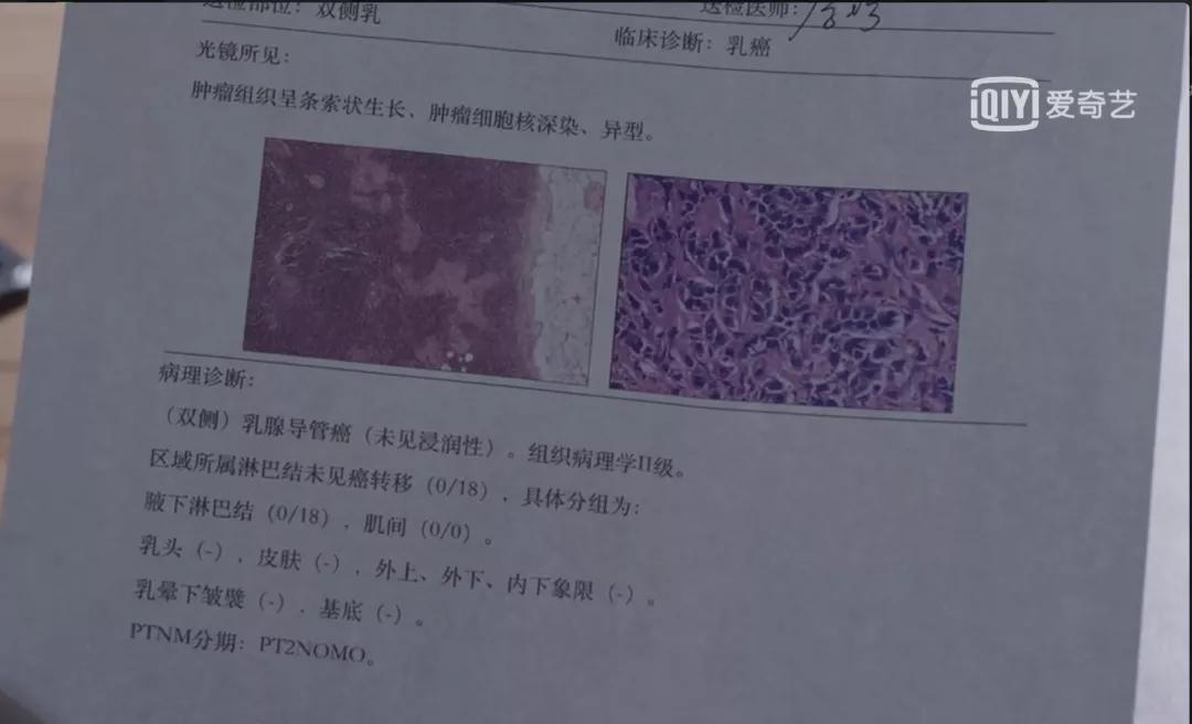 《小欢喜》刘静患乳腺癌令人泪奔,梅奥诊所教你如何降低乳腺癌发病率