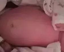                     宝爸宝妈别再乱担心了，宝宝的这28种情况是正常的噢