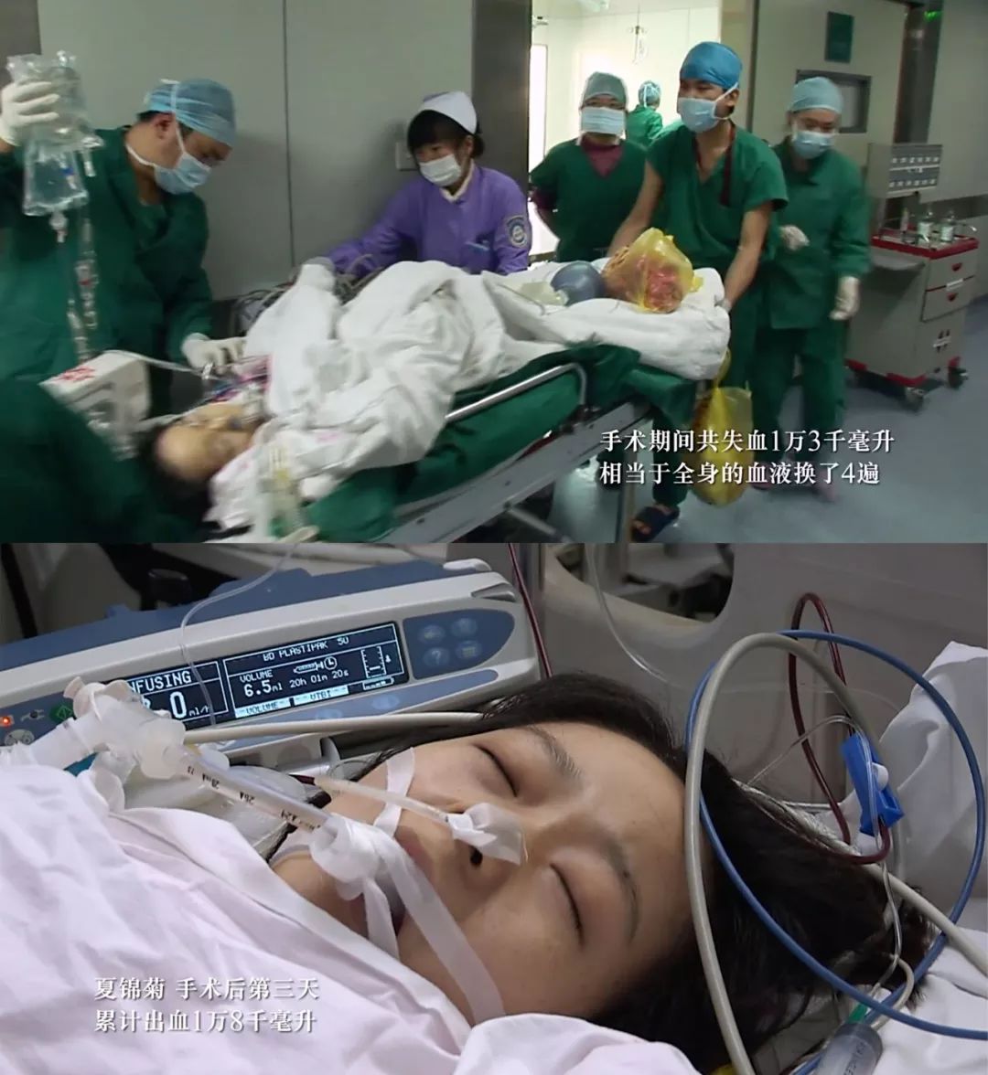 38岁三胎产妇剖腹产视频曝光:你拿命换来的孩