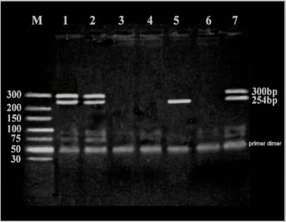 电泳pcr产物显示sry基因的条带大小为254bp