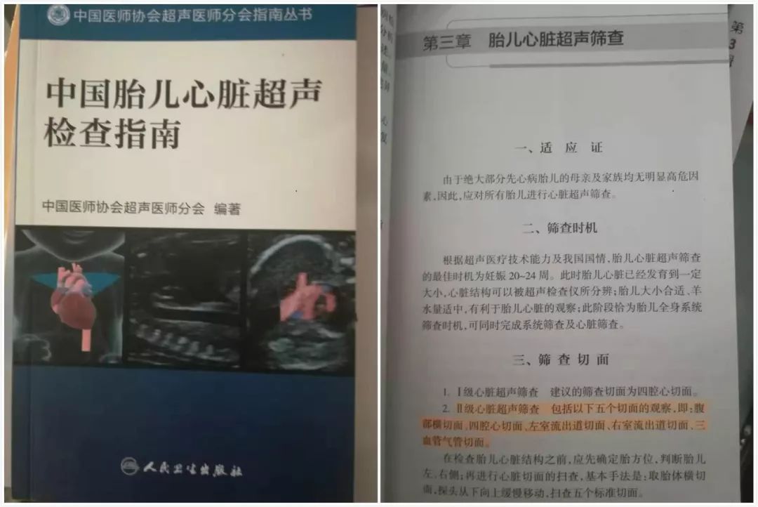 《中国胎儿心脏超声检查指南》