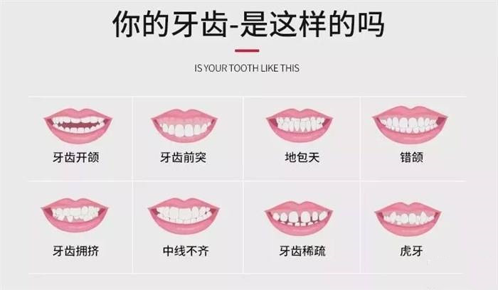 龅牙矫正需要注意的事项是什么