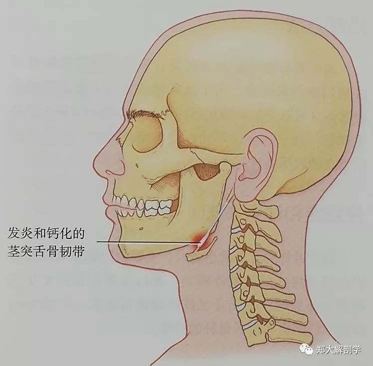 五种引起颌面部的疼痛综合征