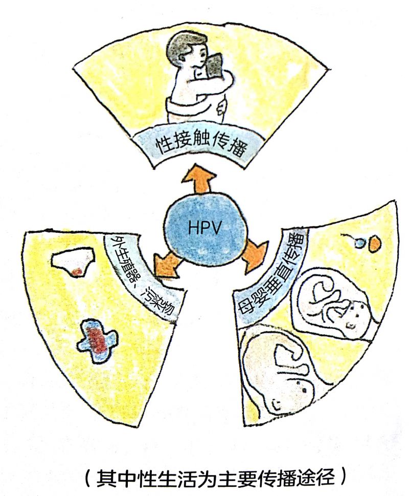 hpv那些事儿_传播