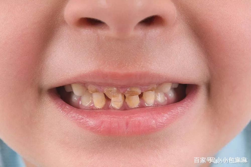                     6岁以前，千万别让孩子刷牙……