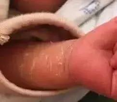                     宝爸宝妈别再乱担心了，宝宝的这28种情况是正常的噢
