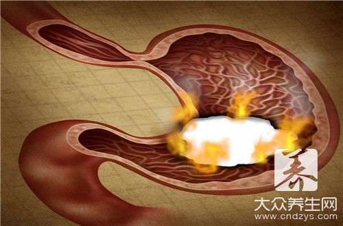 烧心是什么原因引起的，到底该怎么缓解呢