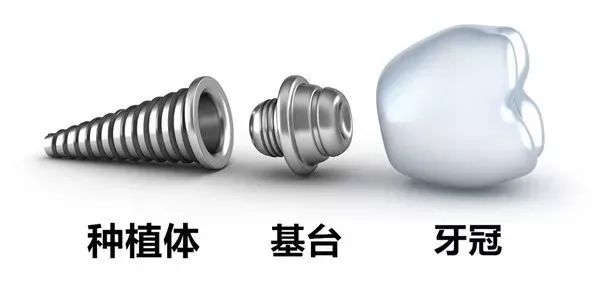 种牙最好的基台 93f9663e1b0f4fdba313c2cfc233c835.jpeg