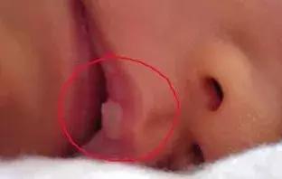                     宝爸宝妈别再乱担心了，宝宝的这28种情况是正常的噢