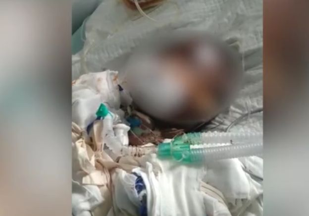 女孩模仿易拉罐爆米花被烧成重伤离世,小编心情复杂你呢? 女孩模仿易拉罐爆米花被烧成重伤离世,小编心情复杂你呢?